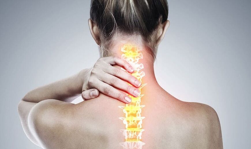 Emakakaela lülisamba osteokondroos