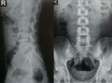 nimmepiirkonna röntgenikiirgus